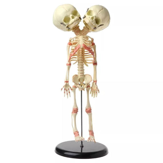 Fetal fetus Skeleton teaching educational Model Double Head Baby Skull Skeleton