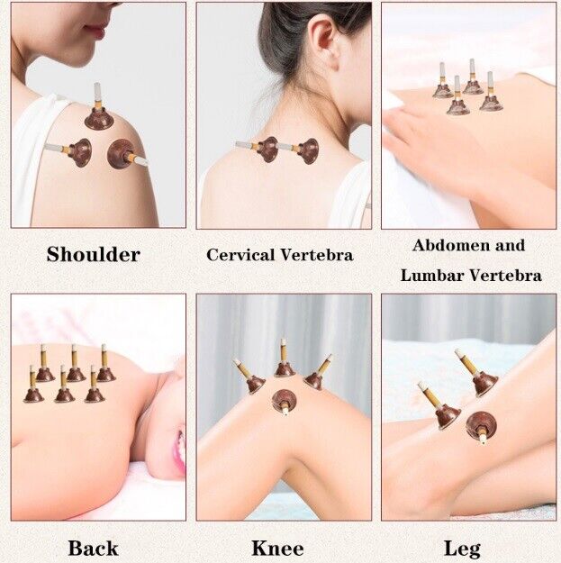Mini Moxa Tubes Self Sticks Chinese Moxibustion Stickers Therapy Massager 180Pcs
