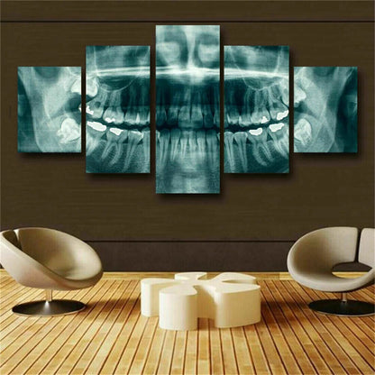 Dental Teeth XRay Posters Dentist 5 Pcs Canvas Wall Art Print Home Decor Picture