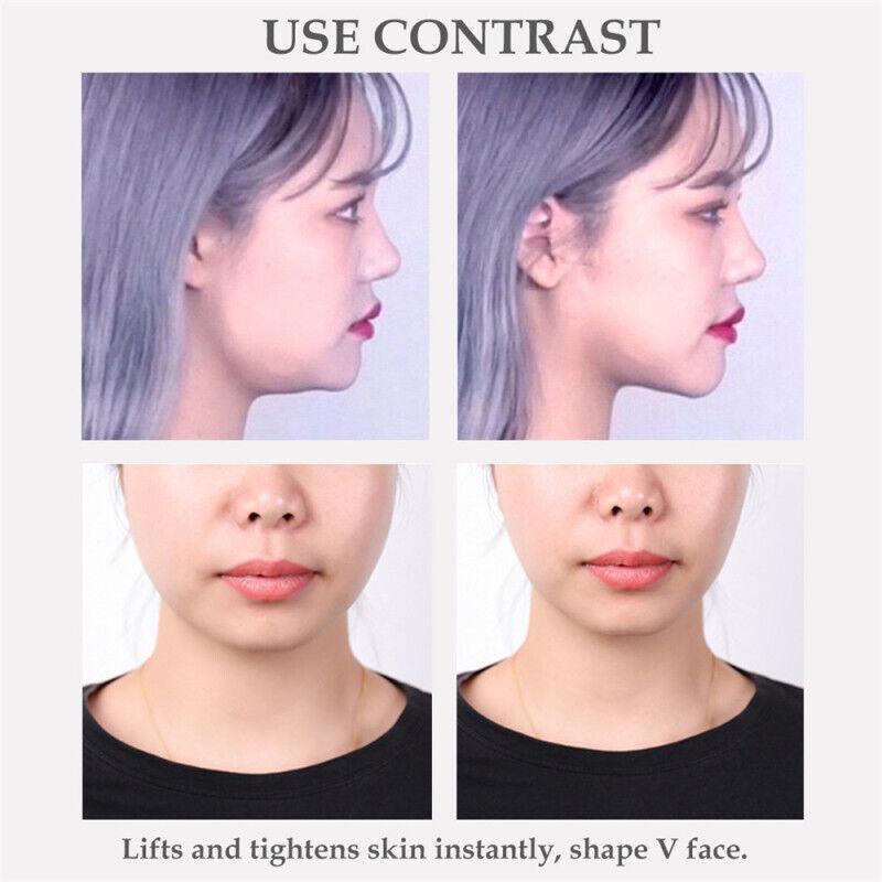 80cinta Adhesiva Impermeable Para Estiramiento Facial Adhesivo Invisible Barbila