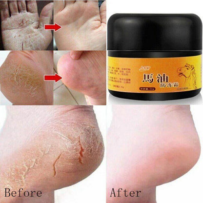 Crema Para Los Pies Manos Puedes Remover La Resequedad Y Las Grietas Rapidamente