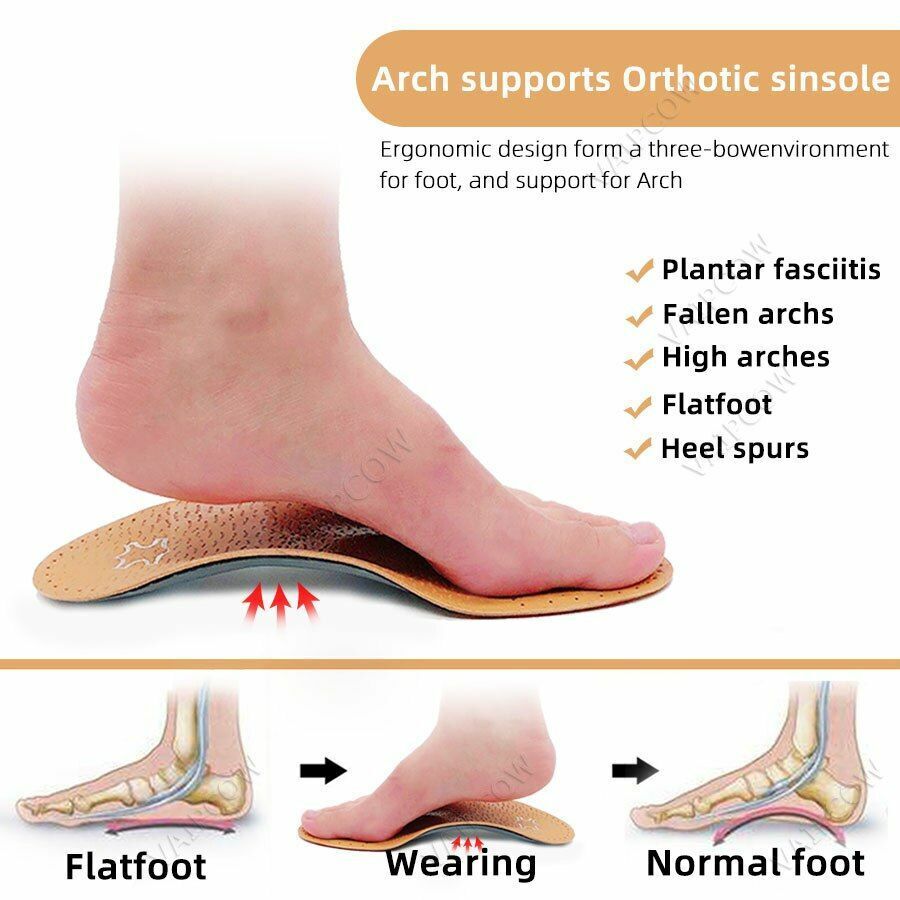 2Pair/Set Premium Leather Orthotic Insole Flat Foot Shoe Insert Arch Support Pad