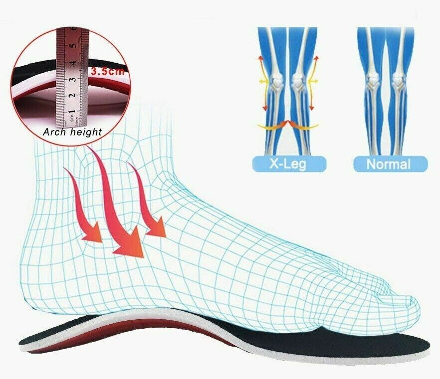 Orthotic Gel High Arch Support Insoles Pad Flat Feet Orthopedic Shoe Care Insert
