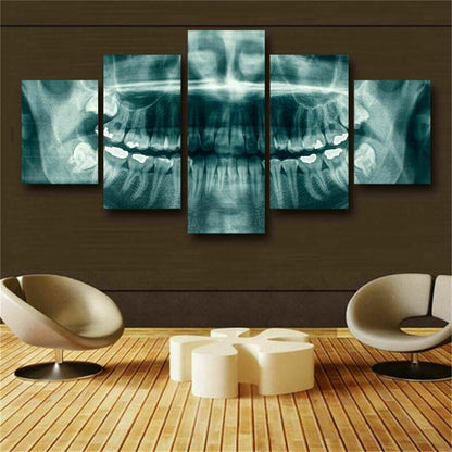 Dental Teeth XRay Posters Dentist 5 Pcs Canvas Wall Art Print Home Decor Picture