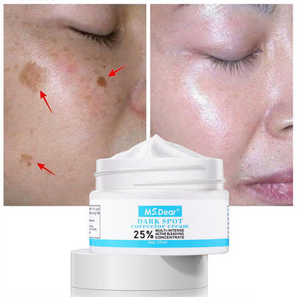 Strong Removal Melasma Whitening Cream Freckle Speckle Sunburn Spots Pigment