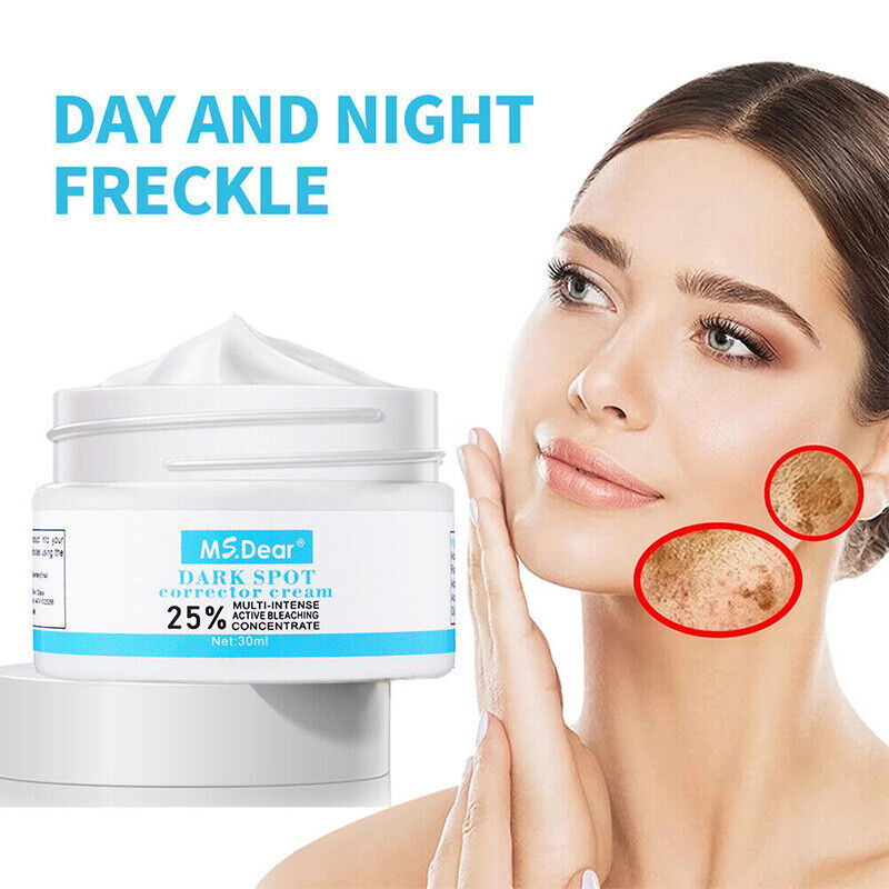 Strong Removal Melasma Whitening Cream Freckle Speckle Sunburn Spots Pigment