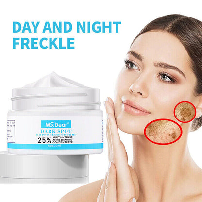 Strong Removal Melasma Whitening Cream Freckle Speckle Sunburn Spots Pigment