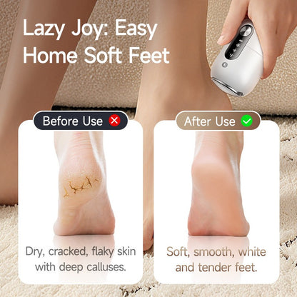 Electric Foot Callus Remover for Rechargeable Electric Foot File Pedicure Tool