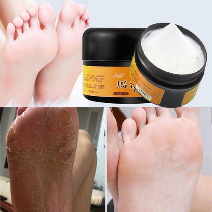 Crema Para Los Pies Manos Puedes Remover La Resequedad Y Las Grietas Rapidamente
